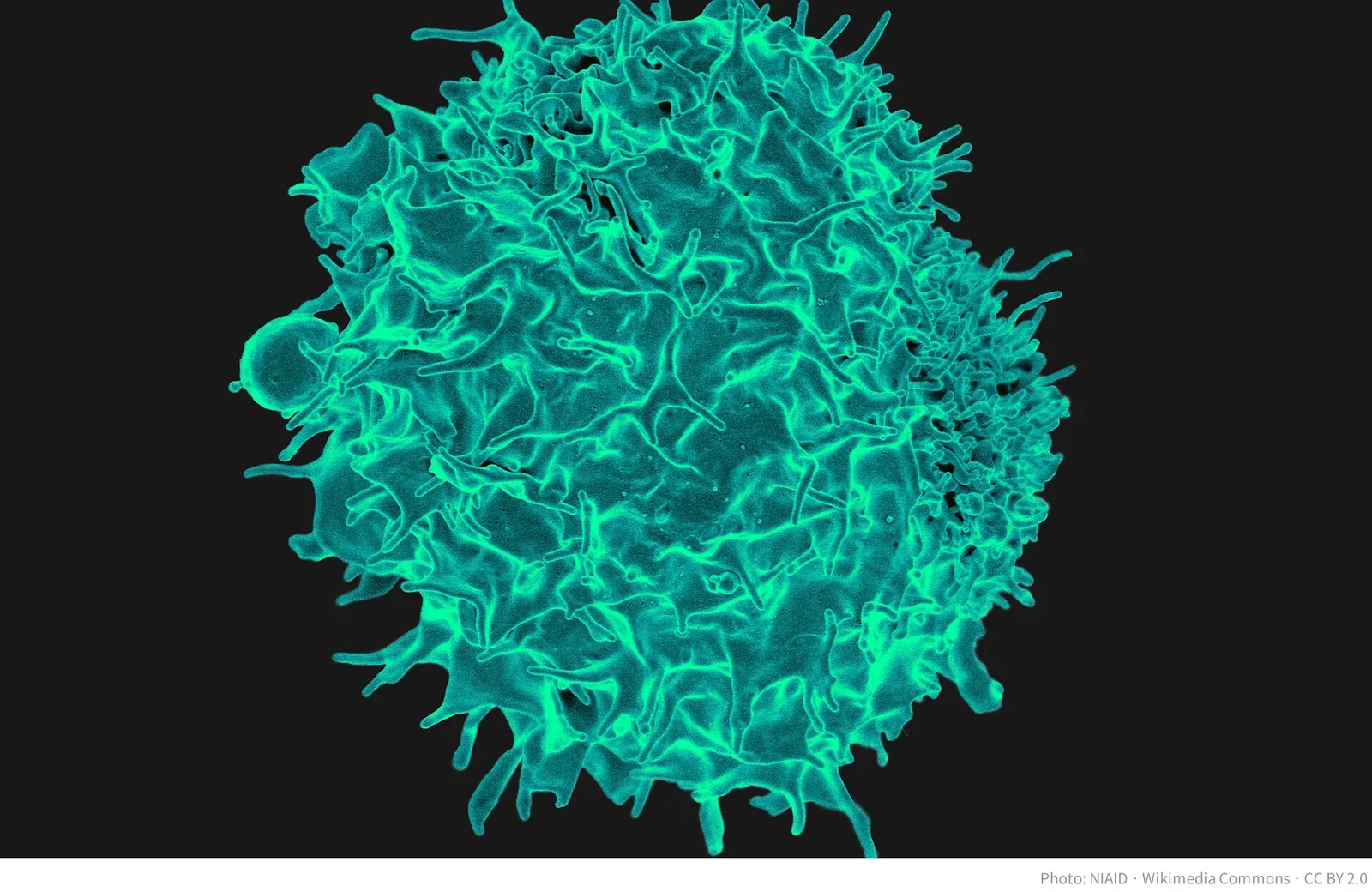 Colorized scanning electron micrograph of a human T cell, the immune cell CAR-T therapies such as CuroCell's Rimcato re-engineer